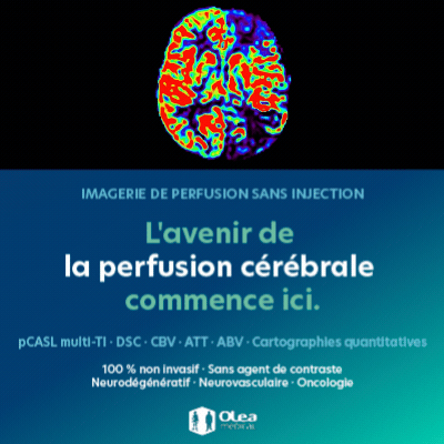 Capsule n°34