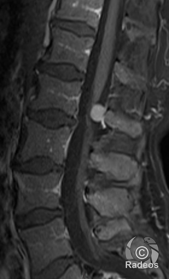 tous-les-cas-cliniques-et-e-learning-en-radiologie-et-imagerie-m-dicale