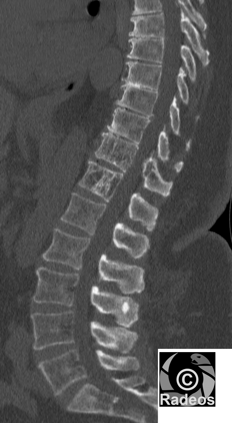 tous-les-cas-cliniques-et-e-learning-en-radiologie-et-imagerie-m-dicale